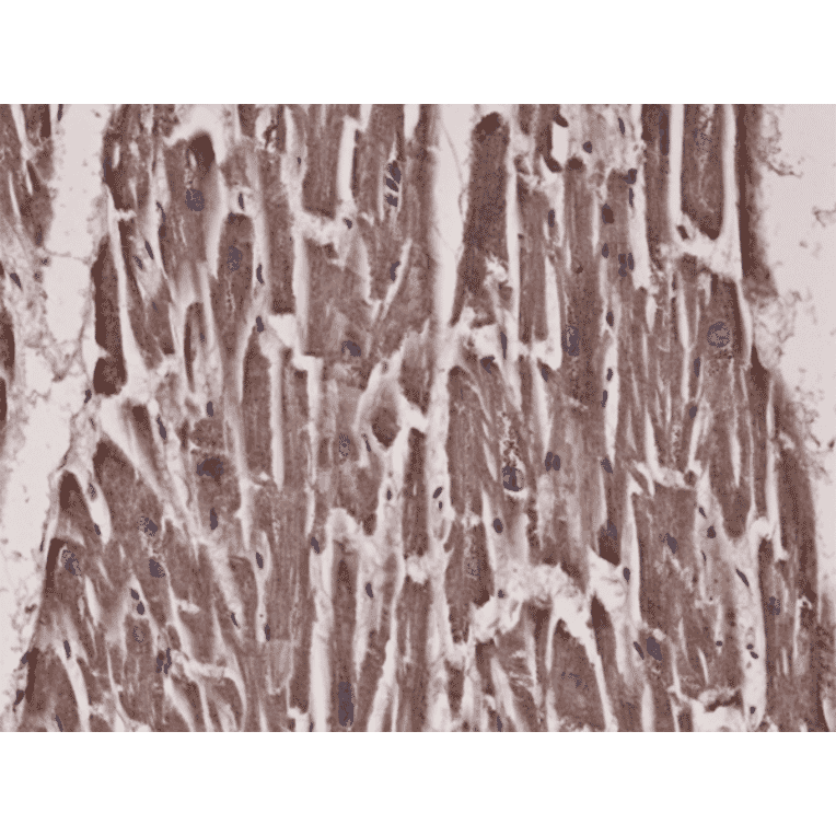 Immunohistochemistry - Anti-acetyl CoA Carboxylase Antibody [RM232] (A121238) - Antibodies.com
