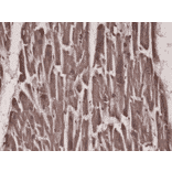 Immunohistochemistry - Anti-acetyl CoA Carboxylase Antibody [RM232] (A121238) - Antibodies.com