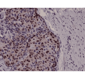Immunohistochemistry - Anti-Cyclin D1 Antibody [RM241] (A121455) - Antibodies.com