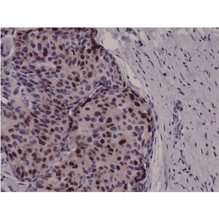 Immunohistochemistry - Anti-Cyclin D1 Antibody [RM241] (A121455) - Antibodies.com