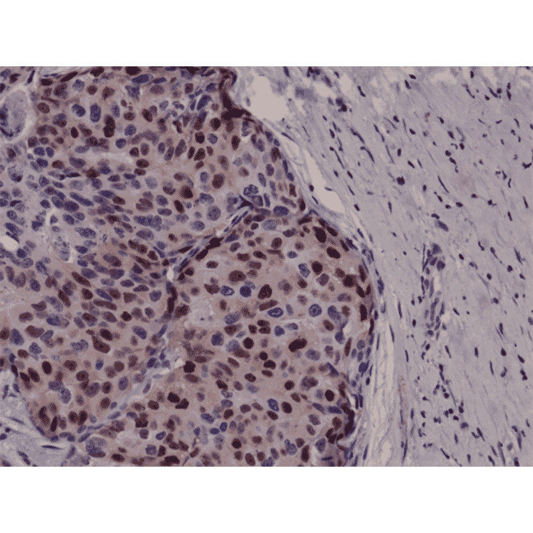 Immunohistochemistry - Anti-Cyclin D1 Antibody [RM241] (A121455) - Antibodies.com
