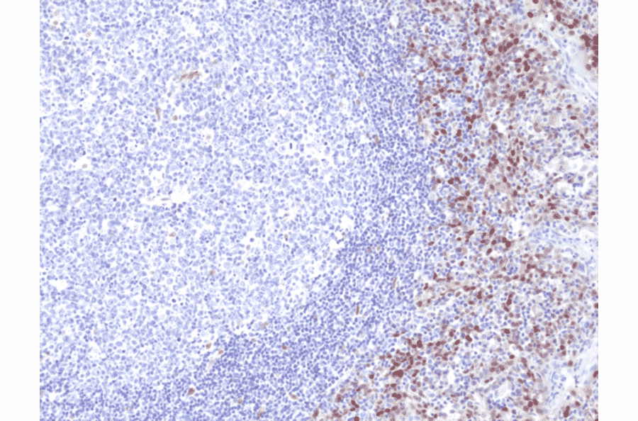 Immunohistochemistry - Anti-Cyclin D1 Antibody [RM241] (A121397) - Antibodies.com