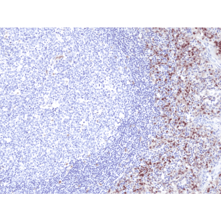 Immunohistochemistry - Anti-Cyclin D1 Antibody [RM241] (A121397) - Antibodies.com