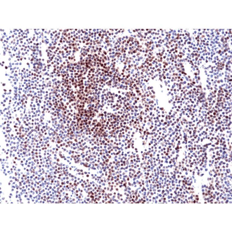 Immunohistochemistry - Anti-Cyclin D1 Antibody [RM241] (A121397) - Antibodies.com