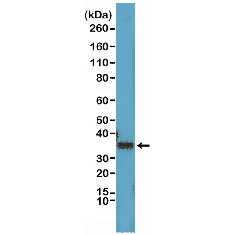 Western Blot - Anti-Cyclin D1 Antibody [RM241] (A121397) - Antibodies.com
