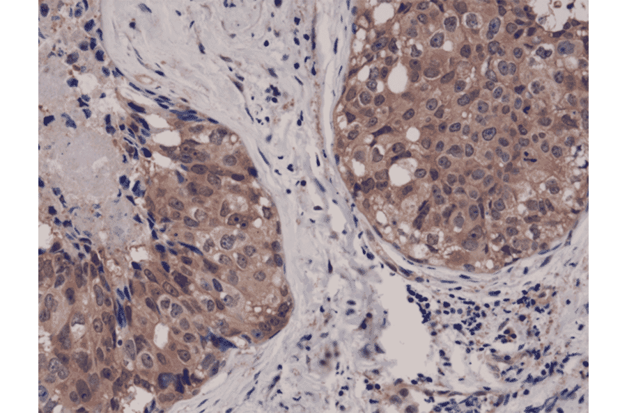Immunohistochemistry - Anti-AKT1 Antibody [RM252] (A121248) - Antibodies.com