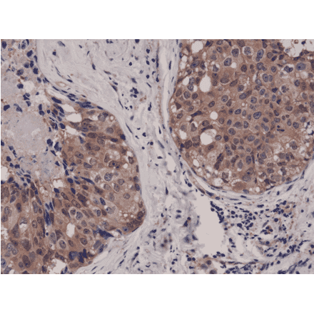Immunohistochemistry - Anti-AKT1 Antibody [RM252] (A121248) - Antibodies.com
