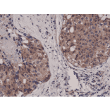 Immunohistochemistry - Anti-AKT1 Antibody [RM252] (A121248) - Antibodies.com