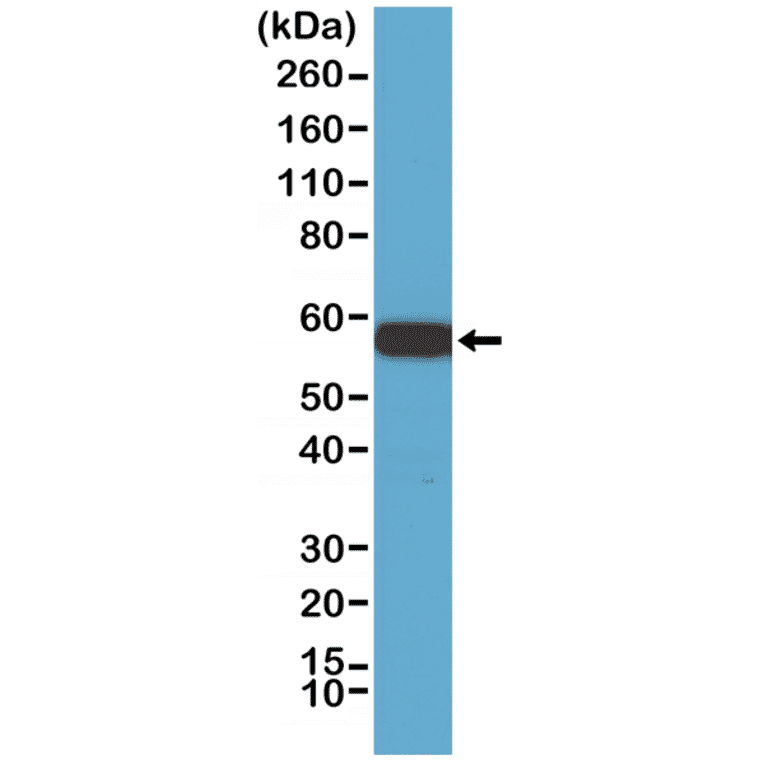 Western Blot - Anti-AKT1 Antibody [RM252] (A121398) - Antibodies.com