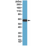 Western Blot - Anti-AKT1 Antibody [RM252] (A121398) - Antibodies.com