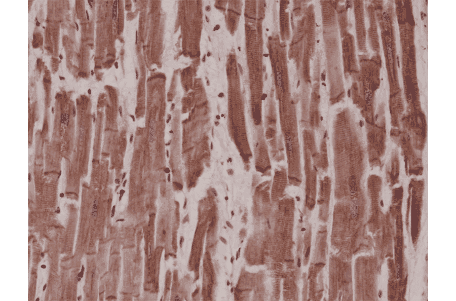 Immunohistochemistry - Anti-Desmin Antibody [RM234] (A121459) - Antibodies.com