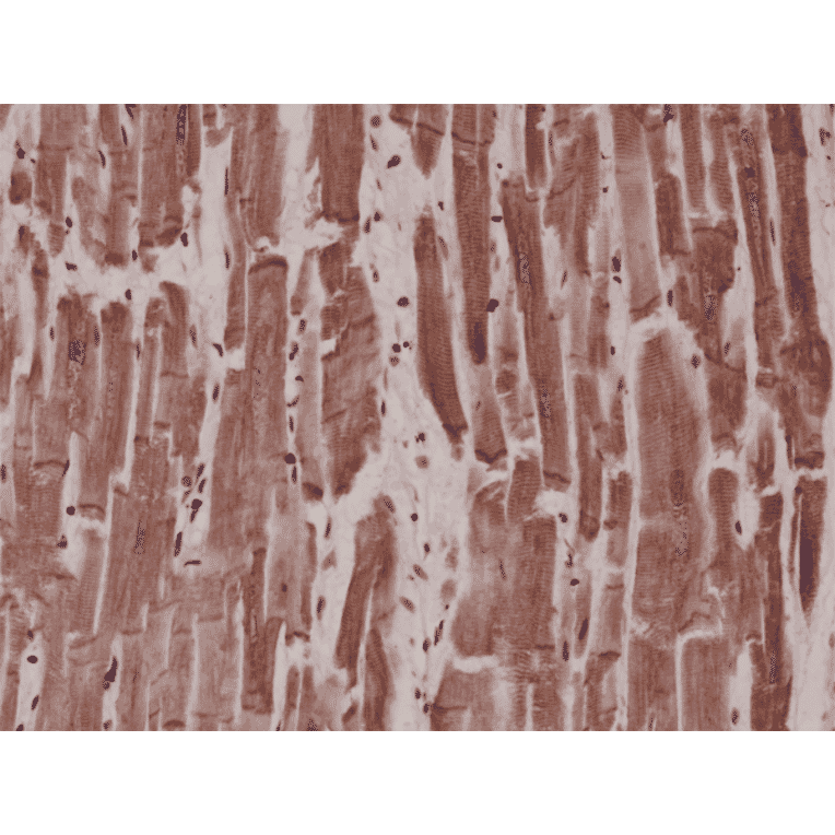 Immunohistochemistry - Anti-Desmin Antibody [RM234] (A121459) - Antibodies.com