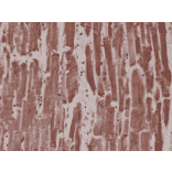 Immunohistochemistry - Anti-Desmin Antibody [RM234] (A121459) - Antibodies.com