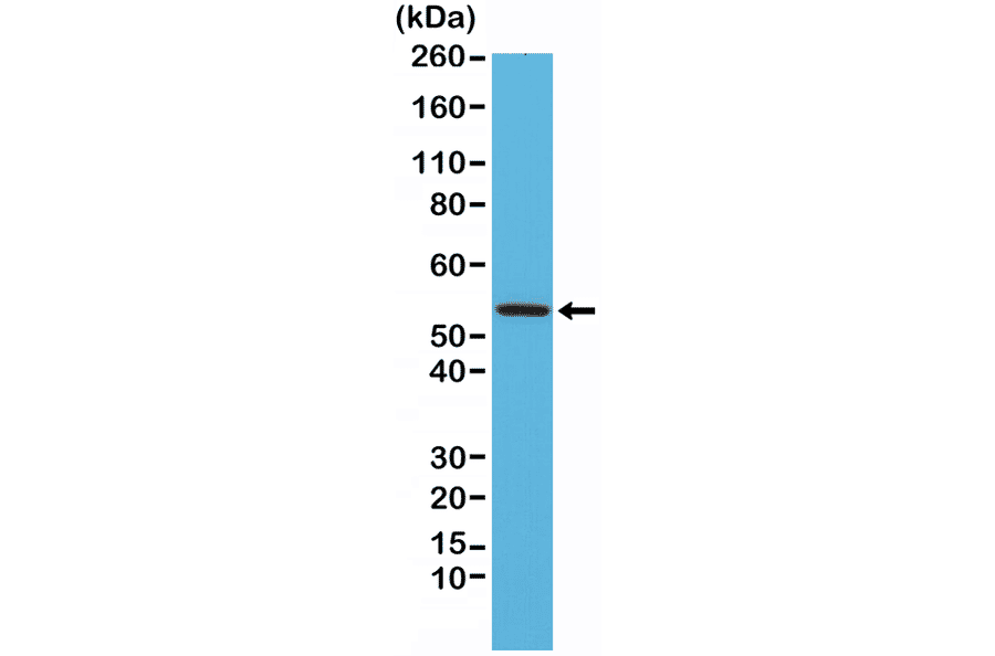 Western Blot - Anti-Desmin Antibody [RM234] (A121399) - Antibodies.com