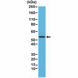 Western Blot - Anti-Desmin Antibody [RM234] (A121399) - Antibodies.com