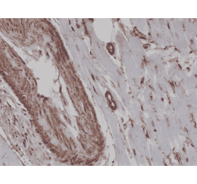 Immunohistochemistry - Anti-alpha Smooth Muscle Actin Antibody [RM253] (A121398) - Antibodies.com