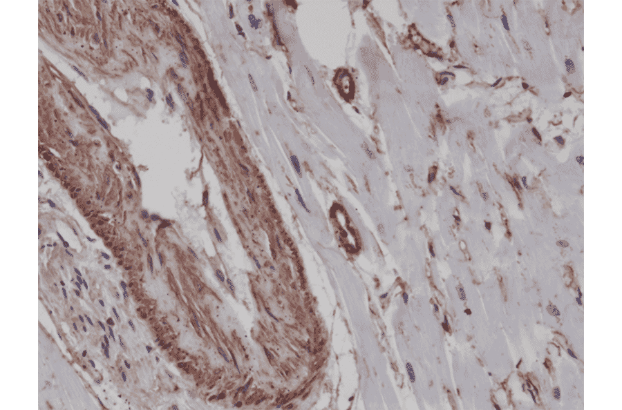 Immunohistochemistry - Anti-alpha Smooth Muscle Actin Antibody [RM253] (A121398) - Antibodies.com