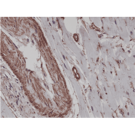 Immunohistochemistry - Anti-alpha Smooth Muscle Actin Antibody [RM253] (A121398) - Antibodies.com