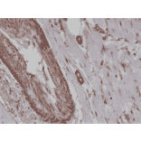 Immunohistochemistry - Anti-alpha Smooth Muscle Actin Antibody [RM253] (A121398) - Antibodies.com