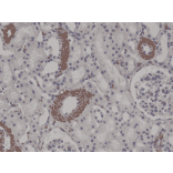 Immunohistochemistry - Anti-alpha Smooth Muscle Actin Antibody [RM253] (A121400) - Antibodies.com