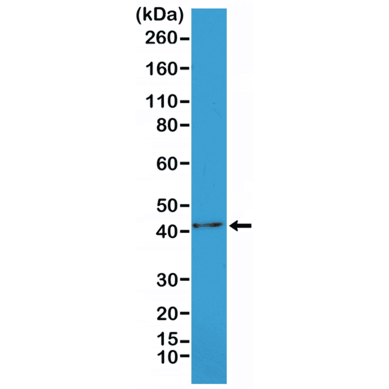 Western Blot - Anti-alpha Smooth Muscle Actin Antibody [RM253] (A121400) - Antibodies.com