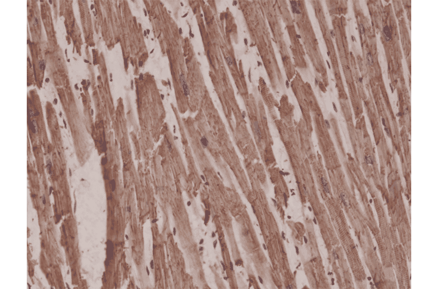 Immunohistochemistry - Anti-alpha Cardiac Actin Antibody [RM257] (A121381) - Antibodies.com