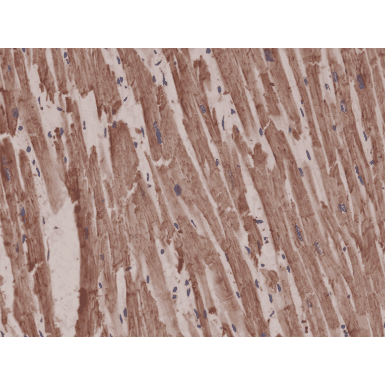 Immunohistochemistry - Anti-alpha Cardiac Actin Antibody [RM257] (A121381) - Antibodies.com