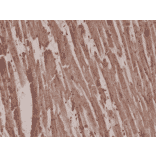 Immunohistochemistry - Anti-alpha Cardiac Actin Antibody [RM257] (A121381) - Antibodies.com