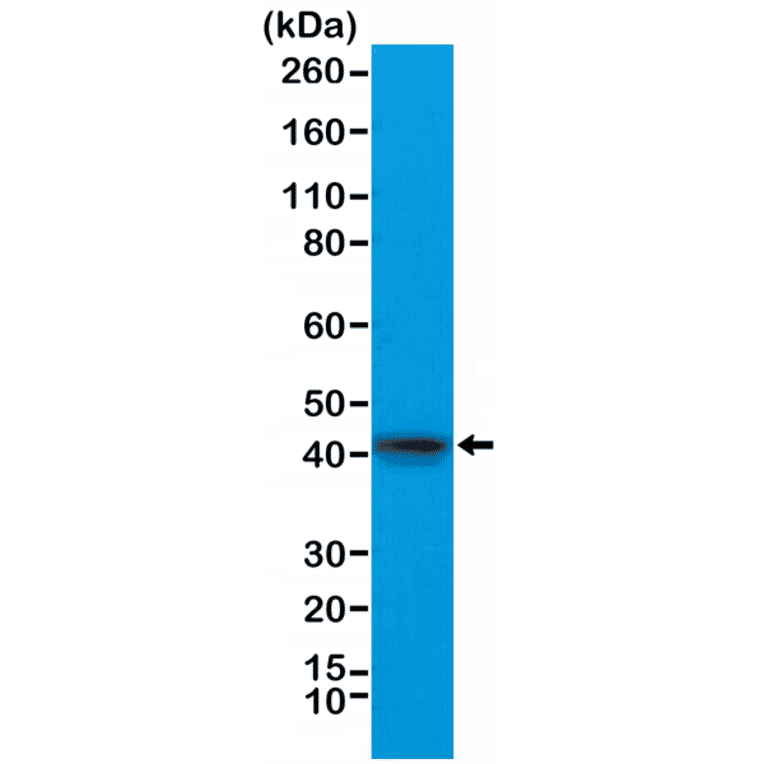Western Blot - Anti-alpha Cardiac Actin Antibody [RM257] (A121401) - Antibodies.com