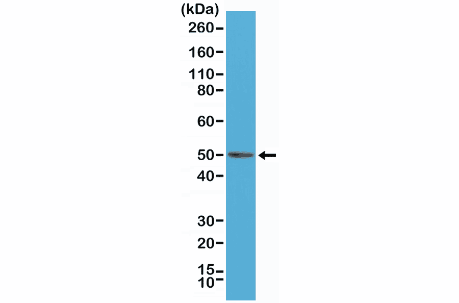 Western Blot - Anti-BAG-1L Antibody [RM310] (A121402) - Antibodies.com