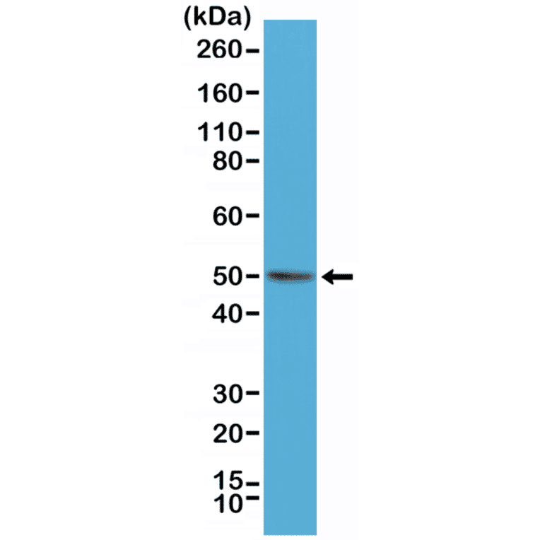 Western Blot - Anti-BAG-1L Antibody [RM310] (A121402) - Antibodies.com