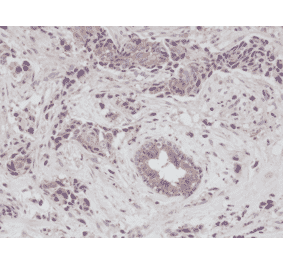 Immunohistochemistry - Anti-EGFR Antibody [RM294] (A121388) - Antibodies.com