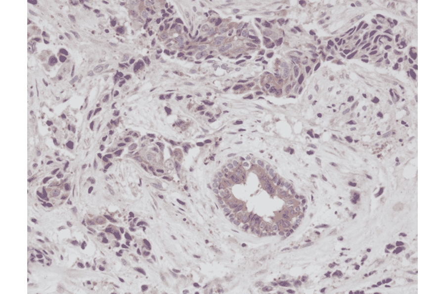 Immunohistochemistry - Anti-EGFR Antibody [RM294] (A121388) - Antibodies.com