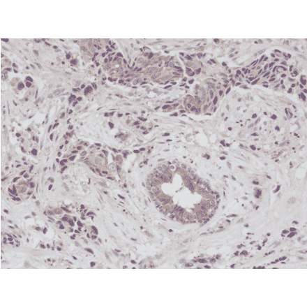 Immunohistochemistry - Anti-EGFR Antibody [RM294] (A121388) - Antibodies.com