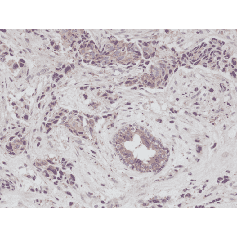 Immunohistochemistry - Anti-EGFR Antibody [RM294] (A121388) - Antibodies.com