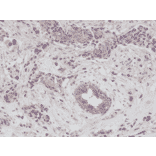 Immunohistochemistry - Anti-EGFR Antibody [RM294] (A121388) - Antibodies.com