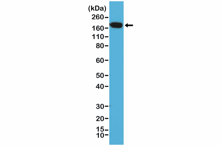 Western Blot - Anti-EGFR Antibody [RM294] (A121406) - Antibodies.com