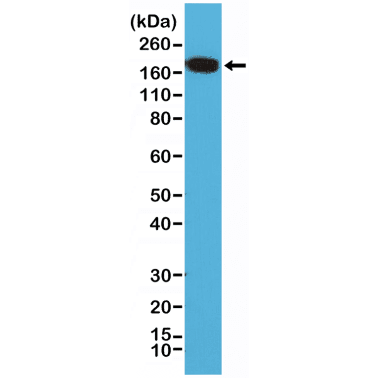 Western Blot - Anti-EGFR Antibody [RM294] (A121406) - Antibodies.com