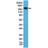 Western Blot - Anti-EGFR Antibody [RM294] (A121406) - Antibodies.com