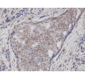 Immunohistochemistry - Anti-CD44 Antibody [RM264] (A121292) - Antibodies.com