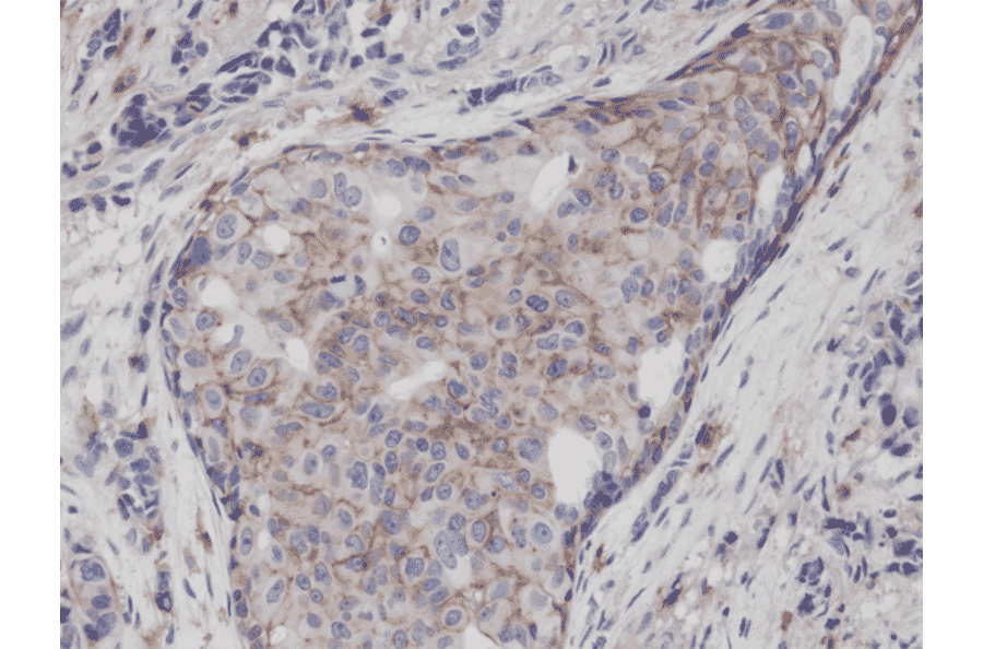 Immunohistochemistry - Anti-CD44 Antibody [RM264] (A121292) - Antibodies.com