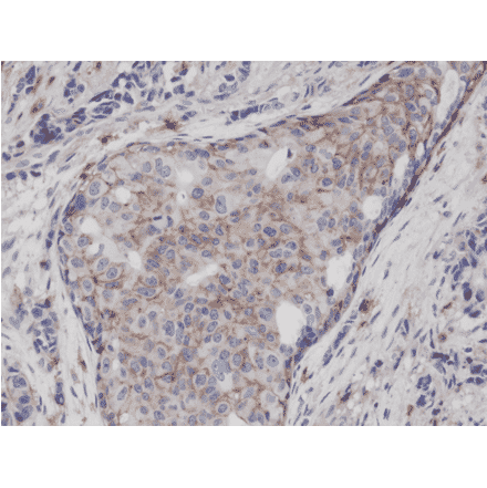 Immunohistochemistry - Anti-CD44 Antibody [RM264] (A121292) - Antibodies.com
