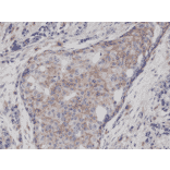 Immunohistochemistry - Anti-CD44 Antibody [RM264] (A121292) - Antibodies.com