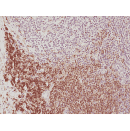 Immunohistochemistry - Anti-CD4 Antibody [RM345] (A121407) - Antibodies.com