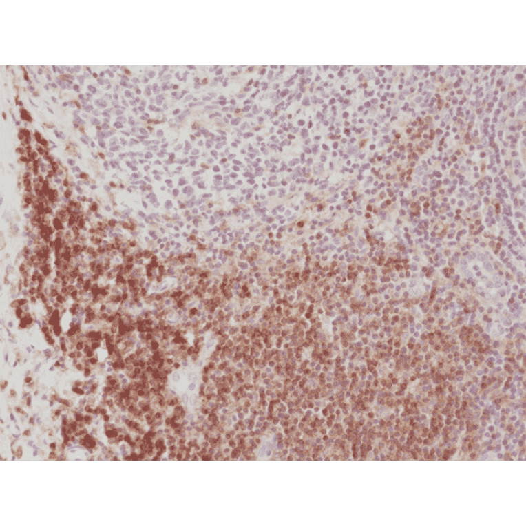 Immunohistochemistry - Anti-CD4 Antibody [RM345] (A121407) - Antibodies.com