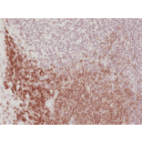 Immunohistochemistry - Anti-CD4 Antibody [RM345] (A121407) - Antibodies.com