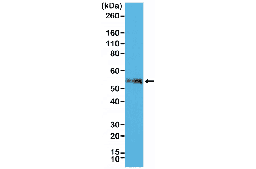 Western Blot - Anti-CD4 Antibody [RM345] (A121409) - Antibodies.com