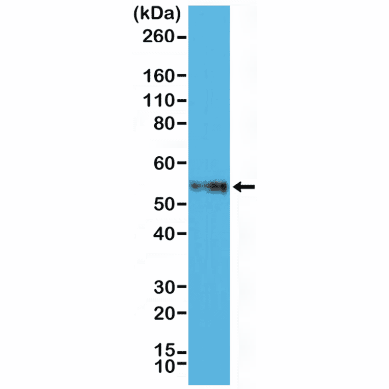 Western Blot - Anti-CD4 Antibody [RM345] (A121409) - Antibodies.com