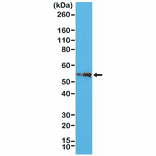 Western Blot - Anti-CD4 Antibody [RM345] (A121409) - Antibodies.com