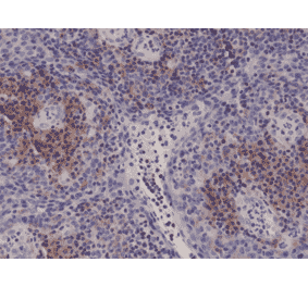 Immunohistochemistry - Anti-Integrin alpha 4 Antibody [RM268] (A121465) - Antibodies.com